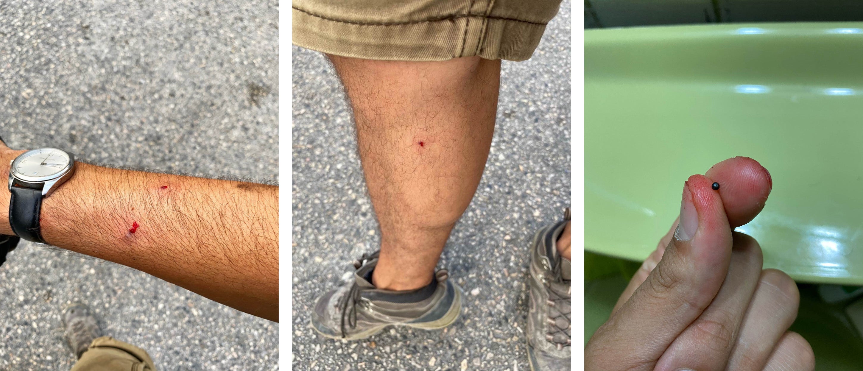 مصور أصيب بالكريات المعدنية.