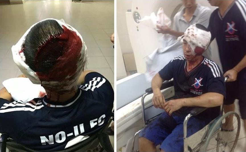 Lã Việt Dũng sau khi bị hành hung ở Hà Nội ngày mồng 10 tháng Bảy năm 2016. 