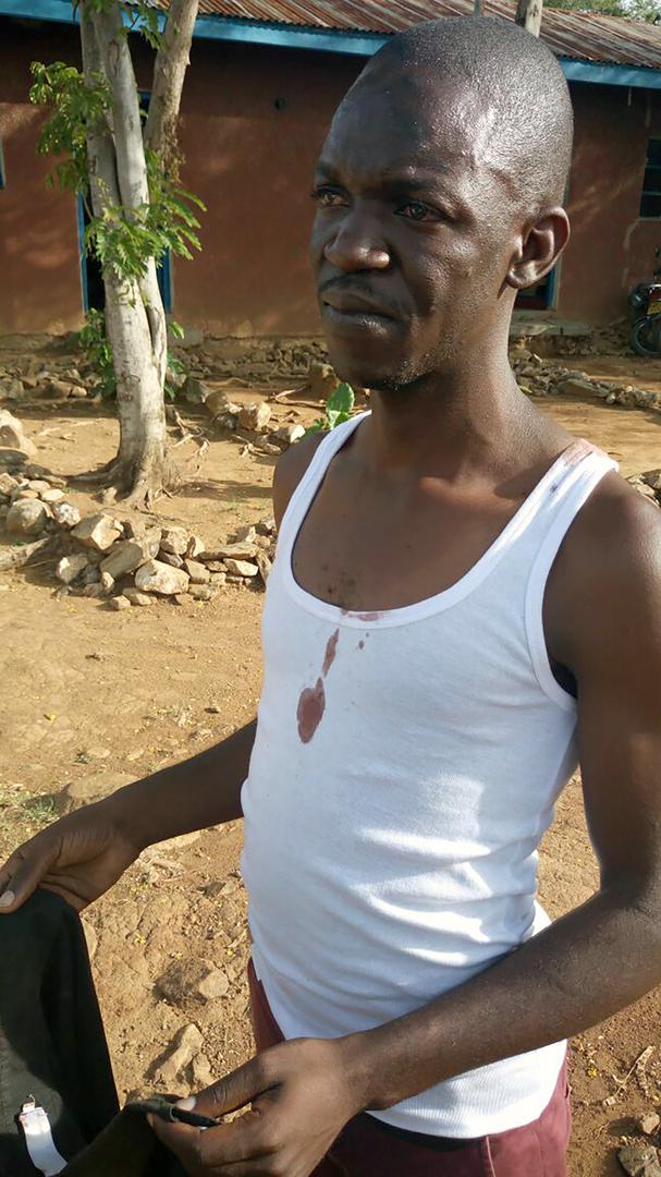 الصحفي إيسياه غوينغي من جريدة ستاندارد، بعد لحظات من الإفراج عنه من قبل شرطة التدخل السريع الكينية في سيايا، غرب كينيا، في 23 مارس/آذار 2017. يُزعم أن الشرطة جردته من ملابسه وركلته وضربته بأعقاب البنادق.