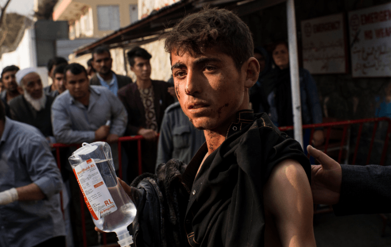 One of the injured receives treatment after an ambulance bombing in Kabul, January 27, 2018.