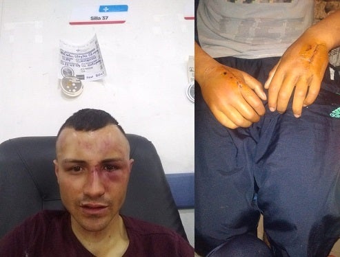 Carlos Steylei Obregon Ramirez at the Kennedy Hospital on November 27, 2019. 