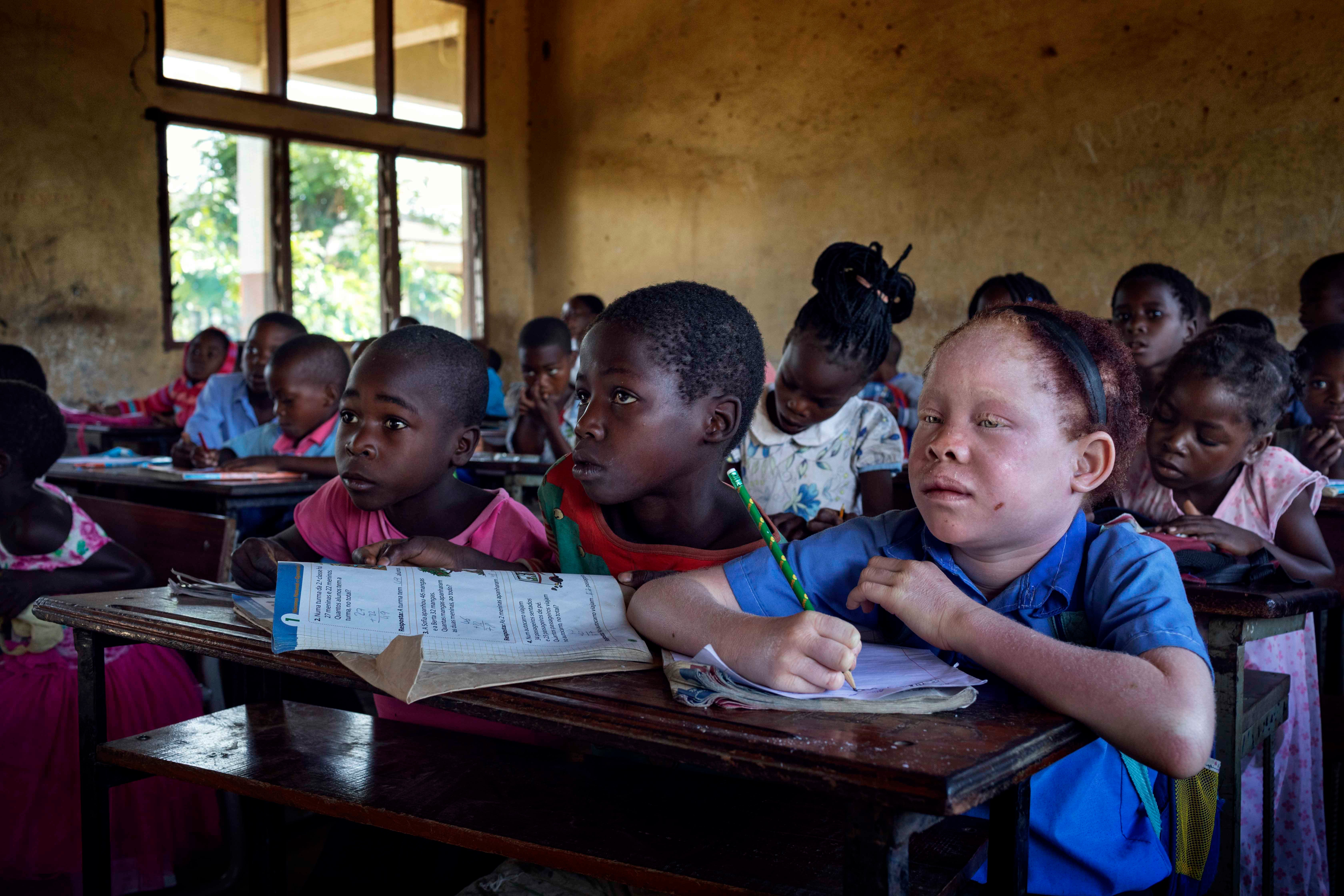 Josina, uma menina com albinismo, em uma sala de aula no distrito de Chiuta, província de Tete, em Moçambique.