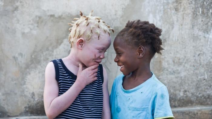 Josina with her niece, Luisa, both 8. “She is my best friend,” said Josina. “She is always asking if I’m ok, she helps me read after school and she looks after me.” 