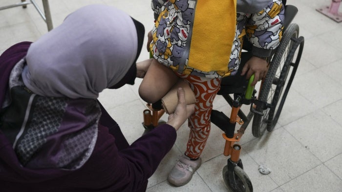 A doctor adjusts the cover on the amputated leg of a 5-year-old Palestinian girl at the Artificial Limbs and Polio Center in Gaza City, February 26, 2025. 