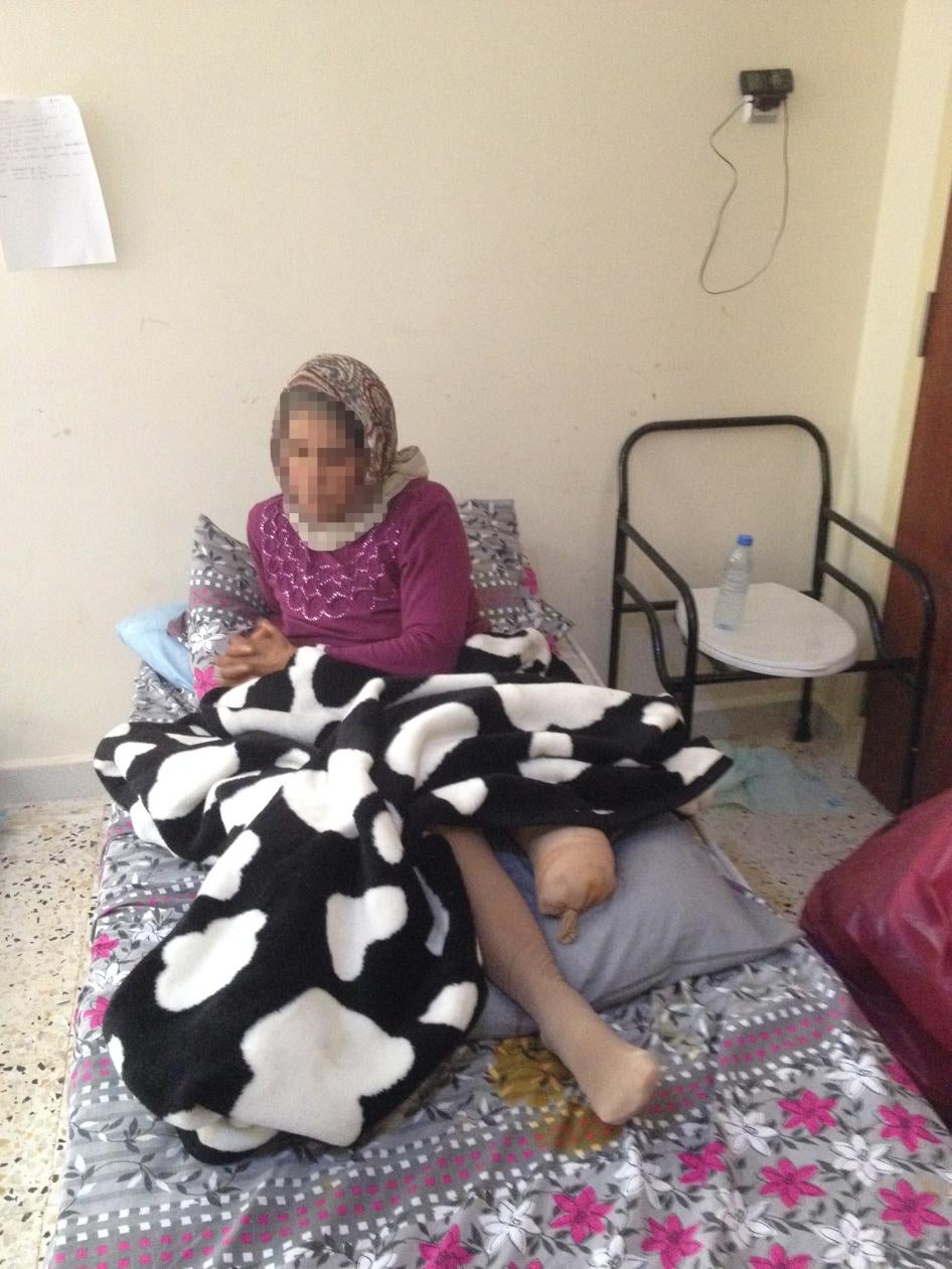 “Selma,” pictured here, and her daughter, were injured in a border minefield. “Selma”’s leg was amputated as a result of the injury.