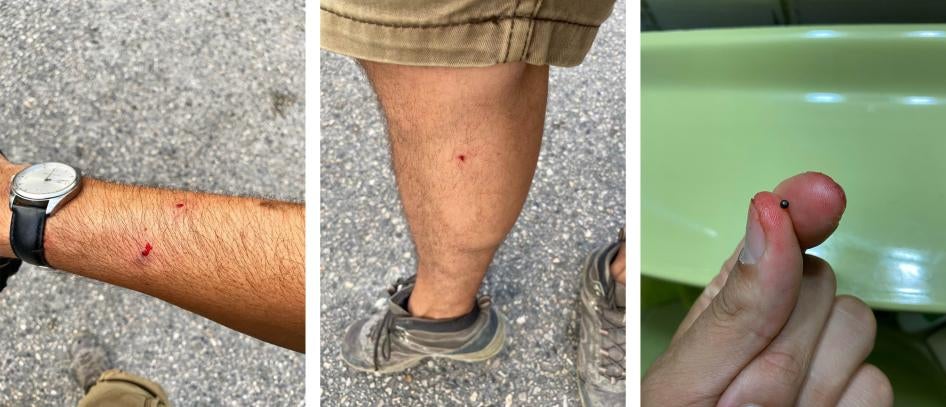 Photographer injured by metal pellets. 