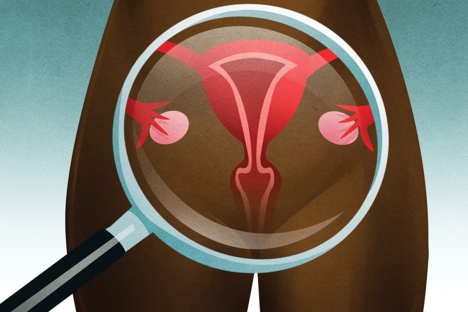 202201us_georgia_cervicalcancer_screening_illustration