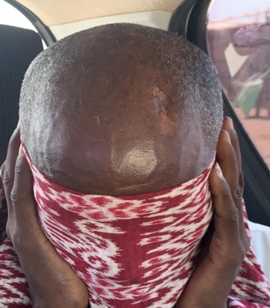 Close up of wounds to the head