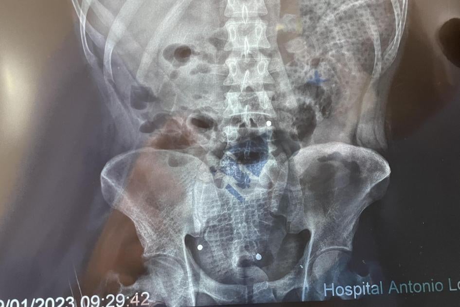 202304americas_peru_edgar_xray