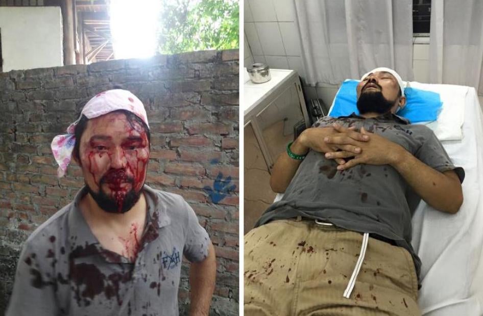 Nguyễn Chí Tuyến sau khi bị hành hung ở Hà Nội ngày 11 tháng Năm năm 2015.