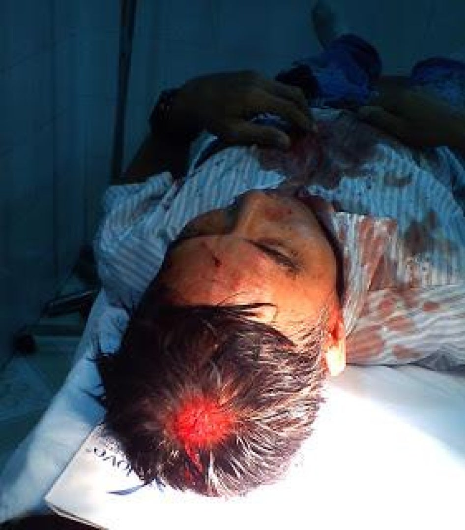 Huỳnh Công Thuận sau khi bị hành hung ở Thành phố Hồ Chí Minh ngày mồng 8 tháng Chín năm 2011.