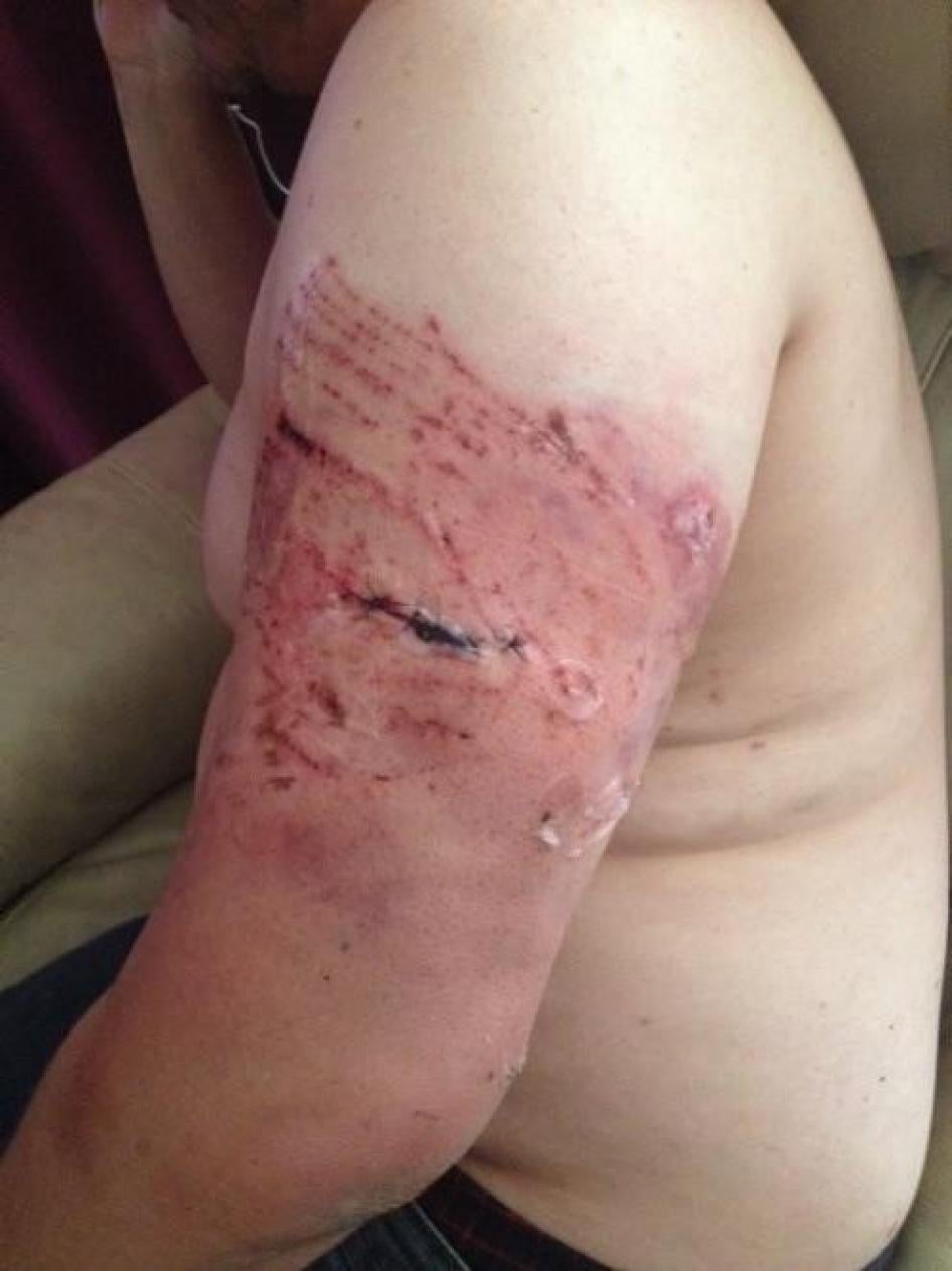 201909US_Tulsa_policing_dogbite1