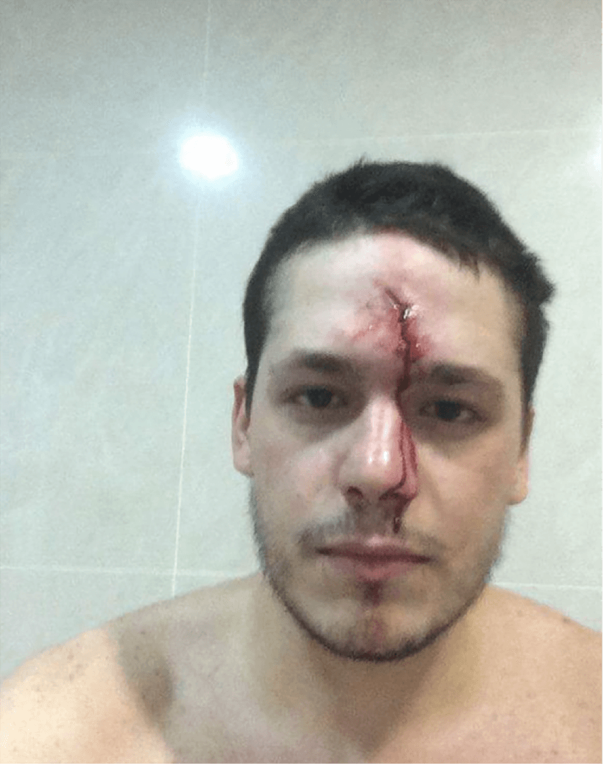 	أصيب المتظاهر إلياس بمقذوفة أطلقتها عليه قوى الأمن اللبنانية يوم 22 أغسطس/آب 2015. © 2015  خاص