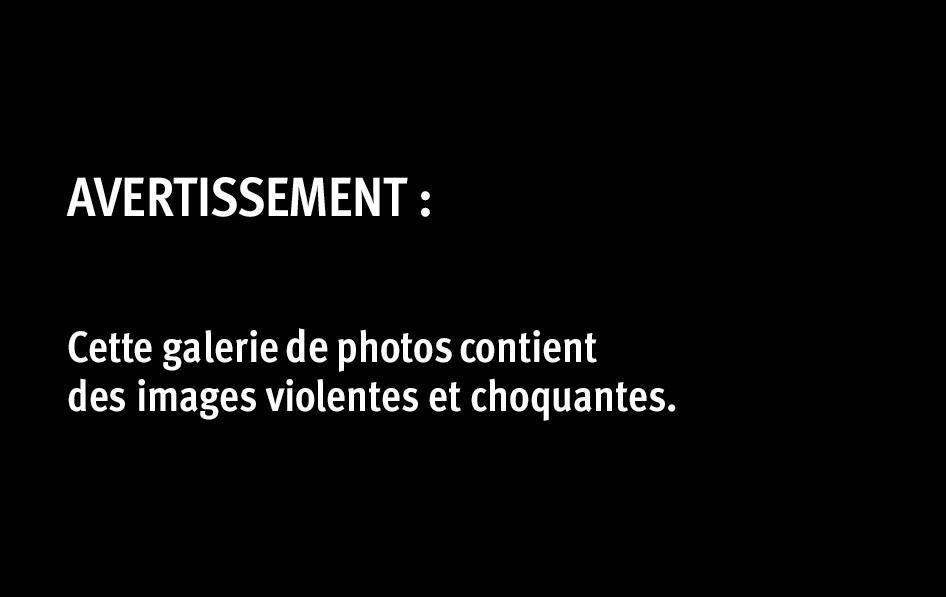 Avertissement: Cette galerie de photos contient des images violentes et choquantes.