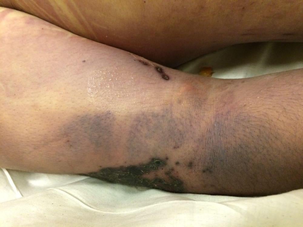 Photos of the bodies of three of the Syrians who died in military custody.