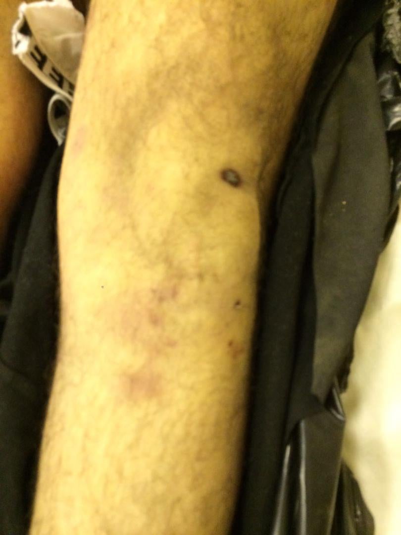 Photos of the bodies of three of the Syrians who died in military custody,