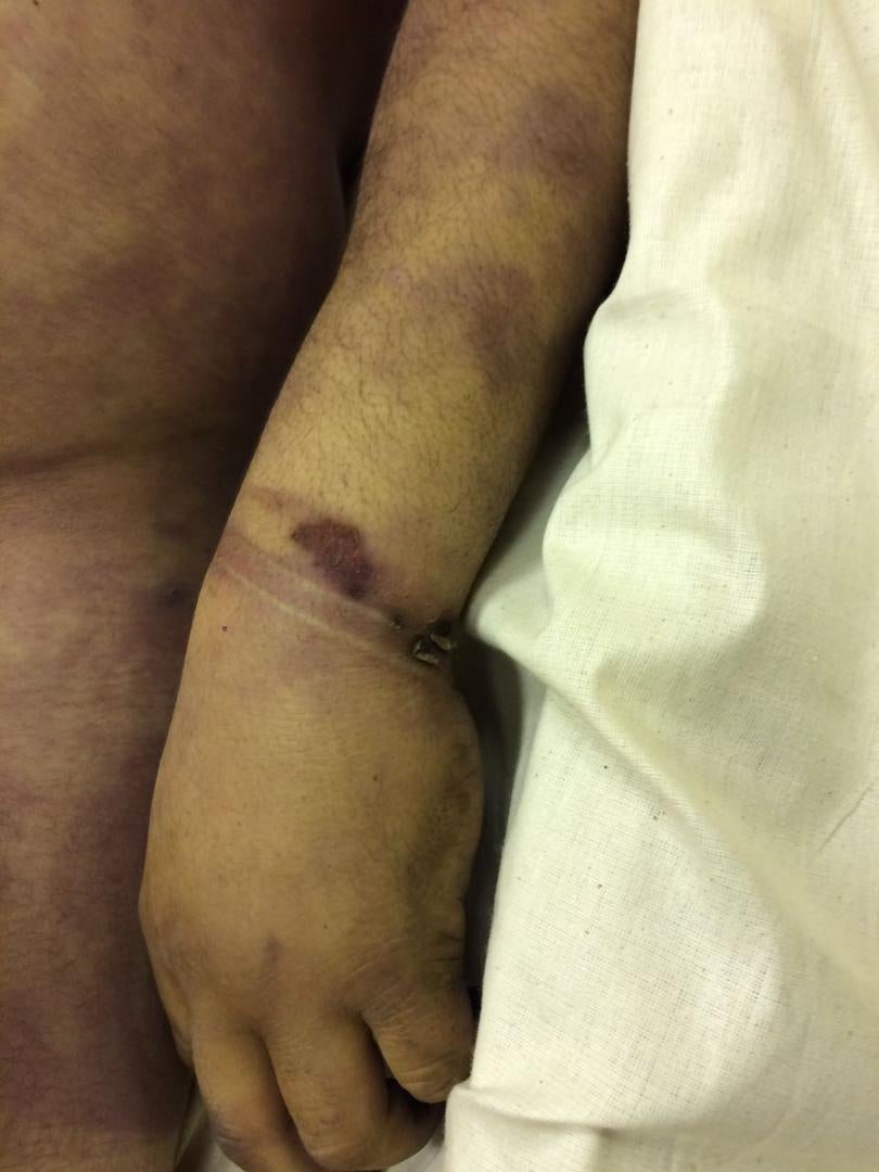 Photos of the bodies of three of the Syrians who died in military custody.