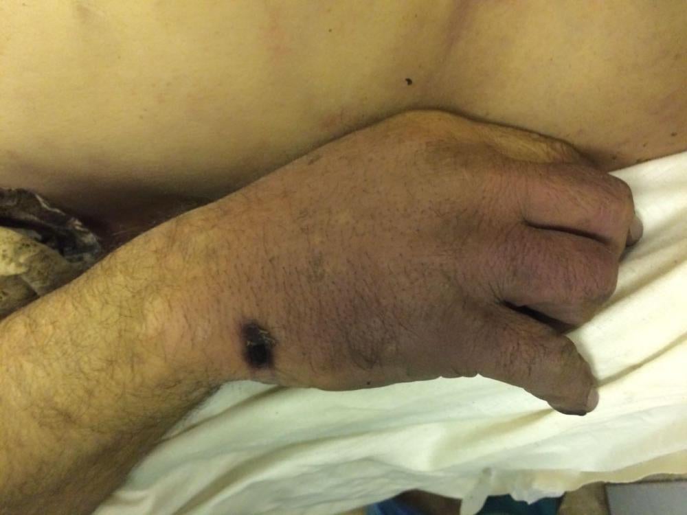 Photos of the bodies of three of the Syrians who died in military custody,