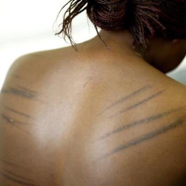 A torture sufferer from Uganda is examined by a doctor at the headquarters of the Medical Foundation for the care of victims of torture in London June 7, 2007. Founded in 1985, the Medical Foundation for the Care of Victims of Torture provides care and re