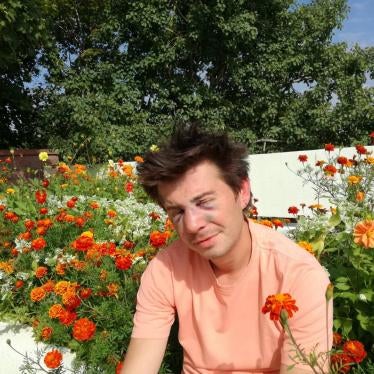 Nikolai Kuprich after the attack.