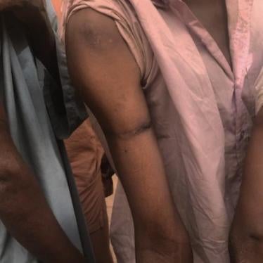  Former detainees show scars on their arms as a result of being restrained with cords or their own turbans  tied tightly around their upper arms by Malian security forces during military operations near Mondoro, December 2018.  © 2019 Corinne Dufka/Human 